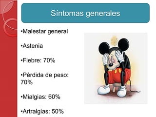 Síntomas generales
•Malestar general
•Astenia
•Fiebre: 70%
•Pérdida de peso:
70%
•Mialgias: 60%
•Artralgias: 50%
 