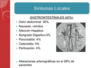 GASTROINTESTINALES (40%)
 Dolor abdominal: 36%.
 Nauseas, vómitos.
 Afección Hepática
 Sangrado Digestivo:3%
 Pancreatitis: 4%
 Colecistitis: 4%
 Perforación: 4%
 Alteraciones arteriográficas en el 58% de
pacientes
Síntomas Locales
 