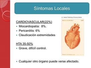 CARDIOVASCULAR(22%)
 Miocardiopatía: 8%.
 Pericarditis: 6%
 Claudicación extremidades
HTA 35-50%
 Grave, difícil control.
 Cualquier otro órgano puede verse afectado.
Síntomas Locales
 