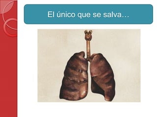 El único que se salva…
 