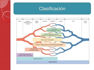Clasificación
 