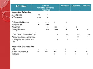 ENTIDAD Arterias
Grandes Medianas
Pequeñas
Arteriolas Capilares Vénulas
Vasculitis Primarias
A.Temporal +++ ++
A.Takayasu +++ +
Poliarteritis Nodosa + +++ ++ ++
A.Kawasaki + +++
Wegener ++ +++ ++ + +
Churg-Strauss ++ +++ + + +
Púrpura Schönlein-Henoch + ++ ++ ++
Púrpura crioglobulinemica + + ++ ++
Poliangitis Microscopica + + +
+++
Vasculitis Secundarias
LES + + ++ + + +
Artritis reumatoide + ++ ++ + + +
Sjögren ++ + + +
 