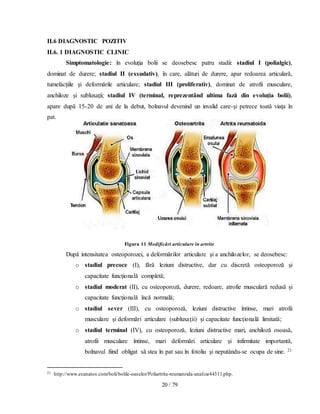 20 / 79
II.6 DIAGNOSTIC POZITIV
II.6. 1 DIAGNOSTIC CLINIC
Simptomatologie: în evoluţia bolii se deosebesc patru stadii: stadiul I (polialgic),
dominat de durere; stadiul II (exsudativ), în care, alături de durere, apar redoarea articulară,
tumefacţiile şi deformările articulare; stadiul III (proliferativ), dominat de atrofii musculare,
anchiloze şi subluxaţii; stadiul IV (terminal, reprezentând ultima fază din evoluţia bolii),
apare după 15-20 de ani de la debut, bolnavul devenind un invalid care-şi petrece toată viaţa în
pat.
Figura 11 Modificări articulare în artrite
După intensitatea osteoporozei, a deformărilor articulare şi a anchilozelor, se deosebesc:
o stadiul precoce (I), fără leziuni distructive, dar cu discretă osteoporoză şi
capacitate funcţională completă;
o stadiul moderat (II), cu osteoporoză, durere, redoare, atrofie musculară redusă şi
capacitate funcţională încă normală;
o stadiul sever (III), cu osteoporoză, leziuni distructive întinse, mari atrofii
musculare şi deformări articulare (subluxaţii) şi capacitate funcţională limitată;
o stadiul terminal (IV), cu osteoporoză, leziuni distructive mari, anchiloză osoasă,
atrofii musculare întinse, mari deformări articulare şi infirmitate importantă,
bolnavul fiind obligat să stea în pat sau în fotoliu şi neputându-se ocupa de sine. 21
21 http://www.esanatos.com/boli/bolile-oaselor/Poliartrita-reumatoida-analize44311.php.
 