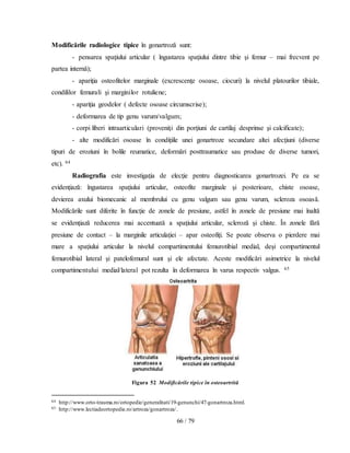 66 / 79
Modificările radiologice tipice în gonartroză sunt:
- pensarea spaţiului articular ( îngustarea spaţiului dintre tibie şi femur – mai frecvent pe
partea internă);
- apariţia osteofitelor marginale (excrescenţe osoase, ciocuri) la nivelul platourilor tibiale,
condililor femurali şi marginilor rotuliene;
- apariţia geodelor ( defecte osoase circumscrise);
- deformarea de tip genu varum/valgum;
- corpi liberi intraarticulari (proveniţi din porţiuni de cartilaj desprinse şi calcificate);
- alte modificări osoase în condiţiile unei gonartroze secundare altei afecţiuni (diverse
tipuri de eroziuni în bolile reumatice, deformări posttraumatice sau produse de diverse tumori,
etc). 64
Radiografia este investigaţia de elecţie pentru diagnosticarea gonartrozei. Pe ea se
evidenţiază: îngustarea spaţiului articular, osteofite marginale şi posterioare, chiste osoase,
devierea axului biomecanic al membrului cu genu valgum sau genu varum, scleroza osoasă.
Modificările sunt diferite în funcţie de zonele de presiune, astfel în zonele de presiune mai înaltă
se evidenţiază reducerea mai accentuată a spaţiului articular, scleroză şi chiste. În zonele fără
presiune de contact – la marginile articulaţiei – apar osteofiţi. Se poate observa o pierdere mai
mare a spaţiului articular la nivelul compartimentului femurotibial medial, deşi compartimentul
femurotibial lateral şi patelofemural sunt şi ele afectate. Aceste modificări asimetrice la nivelul
compartimentului medial/lateral pot rezulta în deformarea în varus respectiv valgus. 65
Figura 52 Modificările tipice în osteoartrită
64 http://www.orto-trauma.ro/ortopedie/generalitati/19-genunchi/47-gonartroza.html.
65 http://www.lectiadeortopedie.ro/artroza/gonartroza/.
 
