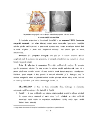 67 / 79
Figura 53 Radiografie în care se observă diminuarea spaţiului articular medial
şi artroza medială a genunchiului
În imagistica genunchiului o importantţă deosebită o are examenul RMN (rezonanţa
magnetică nucleară), care aduce informaţii despre starea meniscurilor, ligamentelor, cartilajului
articular, părtilor moi în general. În gonartrozele avansate acest examen nu mai este necesar, însă
în fazele incipiente el poate face diagnosticul diferenţial între diverse tipuri de leziuni
intraarticulare.
Examenul CT (computer tomograf) este mai util în context traumatic (fracturi
complexe) decât în evaluarea unei gonartroze, iar ecografia articulară are de asemenea o valoare
limitată în această situaţie.
Probe de laborator în gonartroză. Nu există modificări ale probelor de laborator
specifice gonartrozei primitive. Cu toate acestea, în vederea stabilirii unui diagnostic corect cât şi
pentru planificarea operaţiei trebuie efectuate analizele uzuale (hemoleucograma, coagulograma,
biochimia, grupul sangvin şi Rh), precum şi markerii inflamaţiei (PCR, fibrinogen, etc). În
vederea artroplastiei totale de genunchi trebuie exclusă prezenţa oricărei infecţii active, deci se
va efectua şi urocultura şi un consult stomatologic detaliat. 66
CLASIFICAREA se face pe baza examenului clinic, radiologic şi examenului
artroscopic. Astfel gonartroza a fost împărţită în 4 stadii.
 Stadiul I – în care modificările sunt minime, simptomatologia constă în redoare articulară
de repaus, durere moderată şi uneori edem local, radiologic nu există modificări,
artroscopic există semne de degenerare cartilaginoasă (cartilaj moale, opac, posibil
fibrilare fină a acestuia).
66 http://www.orto-trauma.ro/ortopedie/generalitati/19-genunchi/47-gonartroza.html.
 