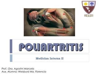 POLIARTRITIS
Medicina Interna II

Prof.: Dra. Agostini Marcela
Aux. Alumno: Weisburd Ma. Florencia

 