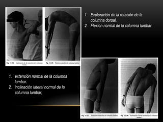1. Exploración de la rotación de la
                                         columna dorsal.
                                      2. Flexion normal de la columna lumbar




1. extensión normal de la columna
   lumbar.
2. inclinación lateral normal de la
   columna lumbar,
 