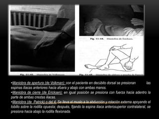 •Maniobra de apertura (de Volkman): con el paciente en decúbito dorsal se presionan              las
espinas iliacas anteriores hacia afuera y abajo con ambas manos.
•Maniobra de cierre (de Ericksen): en igual posición se presiona con fuerza hacia adentro la
parte de ambas crestas iliacas.
•Maniobra (de Patrick) o del 4. Se lleva el muslo a la abducción y rotación externa apoyando el
tobillo sobre la rodilla opuesta; después, fijando la espina iliaca anterosuperior contralateral, se
presiona hacia abajo la rodilla flexionada.
 