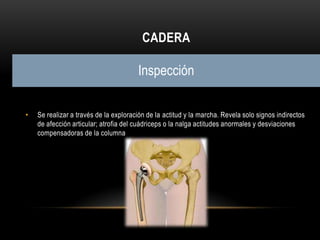 CADERA

                                       Inspección

•   Se realizar a través de la exploración de la actitud y la marcha. Revela solo signos indirectos
    de afección articular; atrofia del cuádriceps o la nalga actitudes anormales y desviaciones
    compensadoras de la columna
 