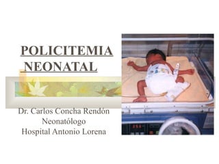POLICITEMIA
NEONATAL
Dr. Carlos Concha Rendón
Neonatólogo
Hospital Antonio Lorena

 