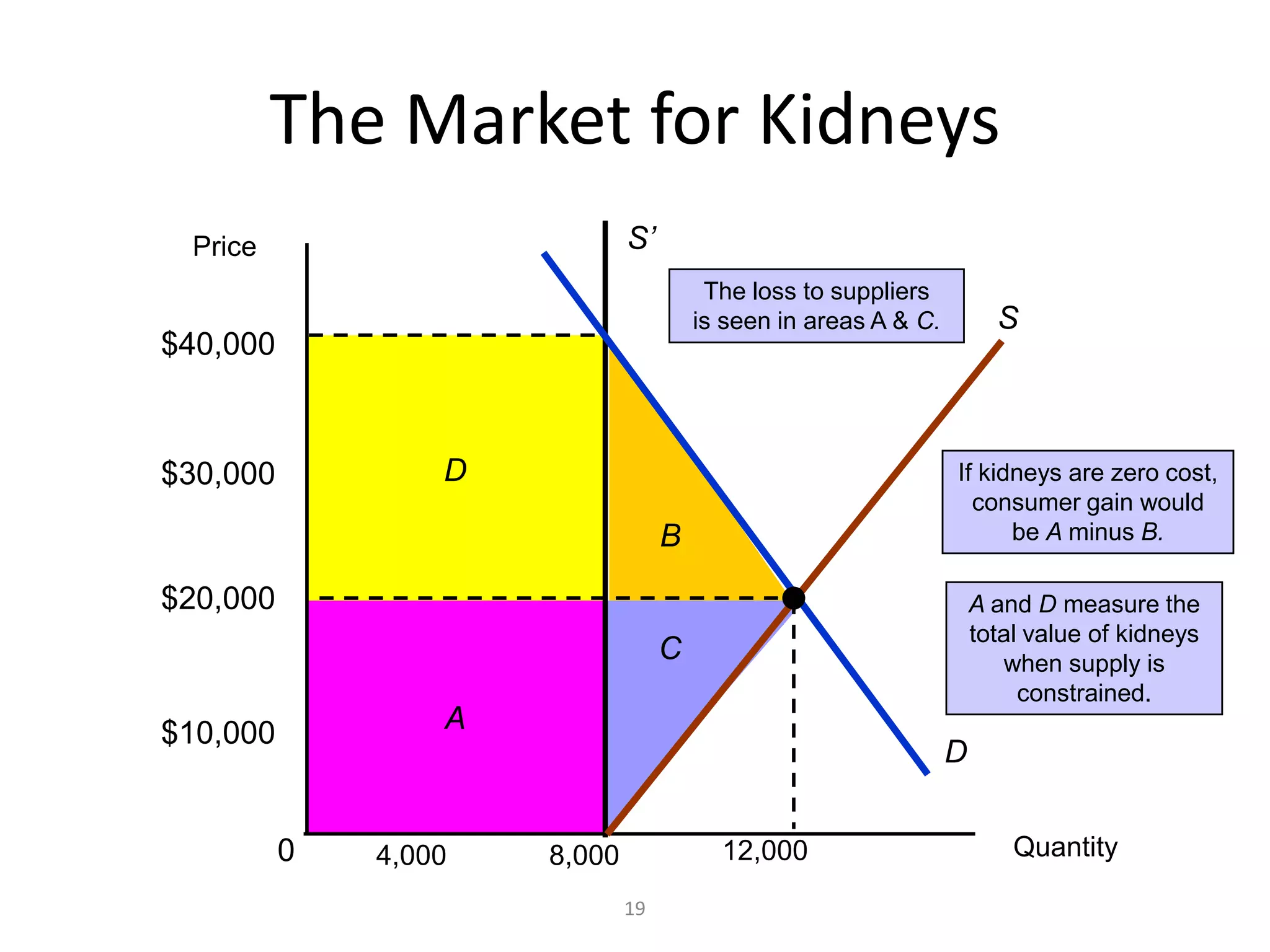 The Market for Kidneys
 Price                        S’
                                        The loss to suppliers
                                       is seen in areas A & C.         S
$40,000



$30,000           D                                              If kidneys are zero cost,
                                                                   consumer gain would
                                   B                                   be A minus B.

$20,000                                                              A and D measure the
                                                                     total value of kidneys
                                   C                                    when supply is
                                                                          constrained.
$10,000           A
                                                                 D


          0   4,000   8,000              12,000                          Quantity

                              19
 