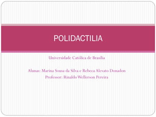 Universidade Católica de Brasília
Alunas: Marina Sousa da Silva e Rebeca Alevato Donadon
Professor: RinaldoWellerson Pereira
POLIDACTILIA
 