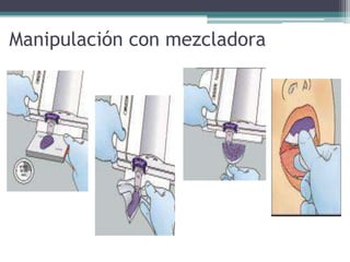  Manipulación con mezcladora