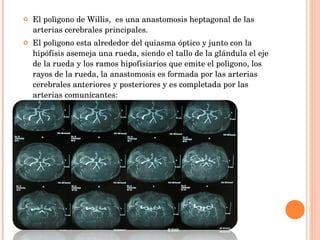 El polìgono de Willis,  es una anastomosis heptagonal de las arterias cerebrales principales. El polìgono esta alrededor del quiasma óptico y junto con la hipófisis asemeja una rueda, siendo el tallo de la glándula el eje de la rueda y los ramos hipofisiarios que emite el polìgono, los rayos de la rueda, la anastomosis es formada por las arterias cerebrales anteriores y posteriores y es completada por las arterias comunicantes: 