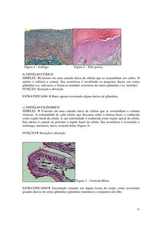 Figura 1 – Esôfago                      Figura 2 – Pele grossa

b) EPITÉLIO CÚBICO
SIMPLES Consiste em uma camada única de células que se assemelham aos cubos. O
núcleo é esférico e central. Sua ocorrência é recobrindo os pequenos ductos em certas
glândulas (ex. salivares), e forma as unidades secretoras de outras glândulas ( ex. tireóide).
FUNÇÃO: Secreção e absorção.

ESTRATIFICADO          Raro, apenas revestindo alguns ductos de glândulas.


c) EPITÉLIO CILÍNDRICO
SIMPLES        Consiste em uma camada única de células que se assemelham a colunas
verticais. A extremidade de cada célula, que descansa sobre a lâmina basal, é conhecida
como região basal da célula. A sua extremidade é conhecida como região apical da célula.
Seu núcleo é central ou próximo a região basal da célula. Sua ocorrência é revestindo o
estômago, intestinos, útero, vesícula biliar (Figura 3).

FUNÇÃO       Secreção e absorção




                                          Figura 3 – Vesícula Biliar

ESTRATIFICADO Encontrado somente em alguns locais do corpo; como revestindo
grandes ductos de certas glândulas (glândulas mamárias) e conjuntiva do olho.




                                                                                           11
 