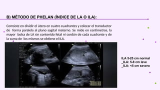 Phelan Normal polihidramnios.ppt en el embarazo a término | PPTX