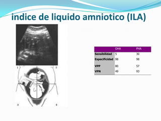 indice de liquido amniotico (ILA)
OHA PHA
Sensibilidad 5 30
Especificidad 98 98
VPP 80 57
VPN 49 93
 