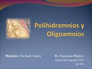 Polihidramnios y oligohidramnios