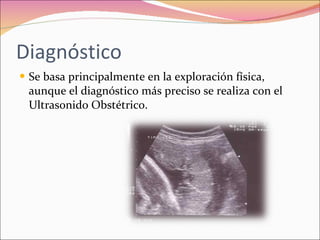 Polihidramnios y oligohidramnios