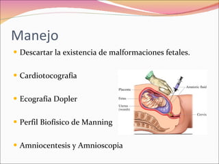 Polihidramnios y oligohidramnios