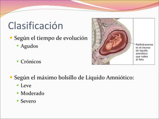 Polihidramnios y oligohidramnios