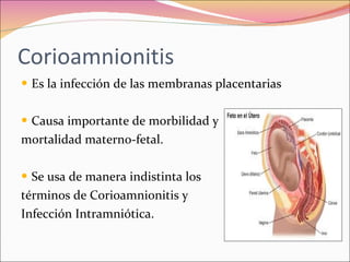Polihidramnios y oligohidramnios