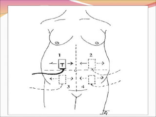 Polihidramnios y oligohidramnios
