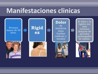 Dolor       El dolor y la
                                   rigidez son
                          de           más
 Persona
mayor de 50
              Rigid   hombros       intensos
                         zona
  años.        ez      lumbar
                                  después de
                                    periodos
                      caderas y   prolongados
                       muslos      de reposo.
 