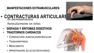 • CONTRACTURAS ARTICULARESEn dermatomiositis
Particularmente en niños
•
•
•
•
 