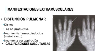 • DISFUNCIÓN PULMONAR
•Disnea
•Tos no productiva
•Neumonitis farmacoinducida
(metotrexato)
•Neumonía por aspiración
 