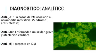 DIAGNÓSTICO: ANALÍTICO
•Anti-Jo1: En casos de PM asociado a
neumonitis intersticial (Síndrome
antisintetasa)
•Anti-SRP: Enfermedad muscular grave
y afectación cardiaca
•Anti-M1: presente en DM
 