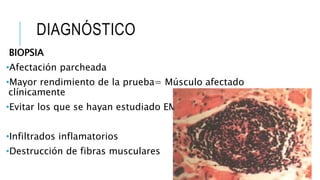 DIAGNÓSTICO
BIOPSIA
•Afectación parcheada
•Mayor rendimiento de la prueba= Músculo afectado
clínicamente
•Evitar los que se hayan estudiado EMG
•Infiltrados inflamatorios
•Destrucción de fibras musculares
 