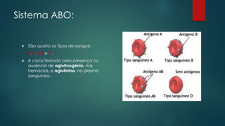 Sistema ABO:
 São quatro os tipos de sangue:
A, B, AB e O.
 é caracterizado pela presença ou
ausência de aglutinogênio, nas
hemácias, e aglutinina, no plasma
sanguíneo.
 