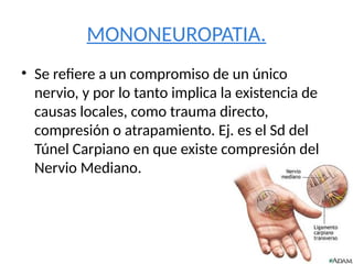 MONONEUROPATIA.
• Se refiere a un compromiso de un único
nervio, y por lo tanto implica la existencia de
causas locales, como trauma directo,
compresión o atrapamiento. Ej. es el Sd del
Túnel Carpiano en que existe compresión del
Nervio Mediano.
 