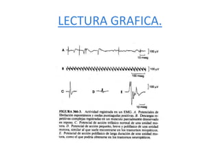 LECTURA GRAFICA.
 