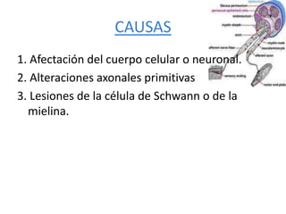 CAUSAS
1. Afectación del cuerpo celular o neuronal.
2. Alteraciones axonales primitivas
3. Lesiones de la célula de Schwann o de la
mielina.
 