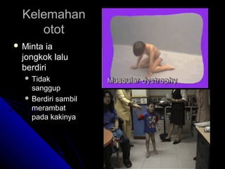 Kelemahan
otot
 Minta

ia
jongkok lalu
berdiri
 Tidak

sanggup
 Berdiri sambil
merambat
pada kakinya

 