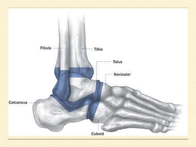 Post polio residual paralysis of foot and ankle