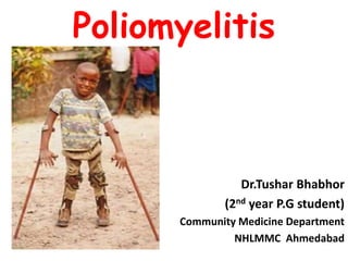 Poliomyelitis
Dr.Tushar Bhabhor
(2nd year P.G student)
Community Medicine Department
NHLMMC Ahmedabad
 