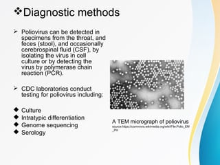 Polio Test Polio | PPT