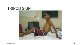 TRIPOD SIGN
18
Monday, August 8, 2022
 