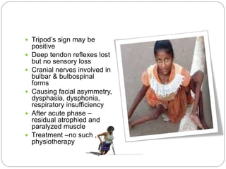 Polio | PPTX