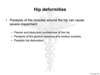 Hip deformities
• Paralysis of the muscles around the hip can cause
severe impairment
– Flexion and abduction contractures of the hip.
– Paralysis of the gluteus maximus and medius muscles.
– Paralytic hip dislocation
 