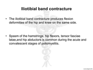 Iliotibial band contracture
• The iliotibial band contracture produces flexion
deformities of the hip and knee on the same side.
• Spasm of the hamstrings, hip flexors, tensor fasciae
latae,and hip abductors is common during the acute and
convalescent stages of poliomyelitis.
 