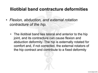 Iliotibial band contracture deformities
• Flexion, abduction, and external rotation
contracture of the hip.
• The iliotibial band lies lateral and anterior to the hip
joint, and its contracture can cause flexion and
abduction deformity. The hip is externally rotated for
comfort and, if not corrected, the external rotators of
the hip contract and contribute to a fixed deformity
 