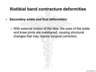Iliotibial band contracture deformities
• Secondary ankle and foot deformities:
– With external torsion of the tibia, the axes of the ankle
and knee joints are malaligned, causing structural
changes that may require surgical correction.
 