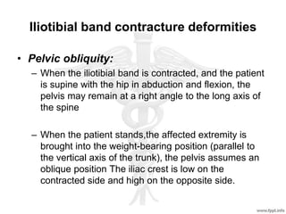Iliotibial band contracture deformities
• Pelvic obliquity:
– When the iliotibial band is contracted, and the patient
is supine with the hip in abduction and flexion, the
pelvis may remain at a right angle to the long axis of
the spine
– When the patient stands,the affected extremity is
brought into the weight-bearing position (parallel to
the vertical axis of the trunk), the pelvis assumes an
oblique position The iliac crest is low on the
contracted side and high on the opposite side.
 