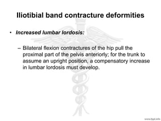 Iliotibial band contracture deformities
• Increased lumbar lordosis:
– Bilateral flexion contractures of the hip pull the
proximal part of the pelvis anteriorly; for the trunk to
assume an upright position, a compensatory increase
in lumbar lordosis must develop.
 