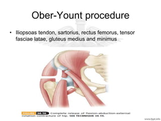 Ober-Yount procedure
• Iliopsoas tendon, sartorius, rectus femorus, tensor
fasciae latae, gluteus medius and minimus
 