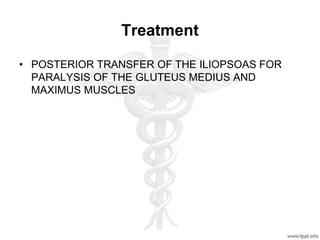 Treatment
• POSTERIOR TRANSFER OF THE ILIOPSOAS FOR
PARALYSIS OF THE GLUTEUS MEDIUS AND
MAXIMUS MUSCLES
 